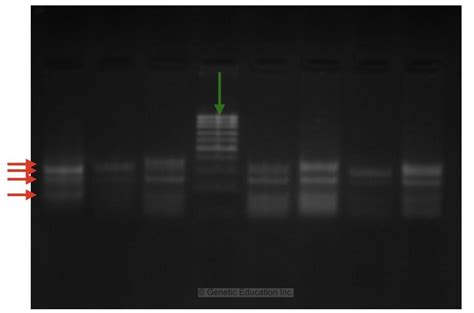 reading gel electrophoresis results|Lab 4: Gel Electrophoresis.